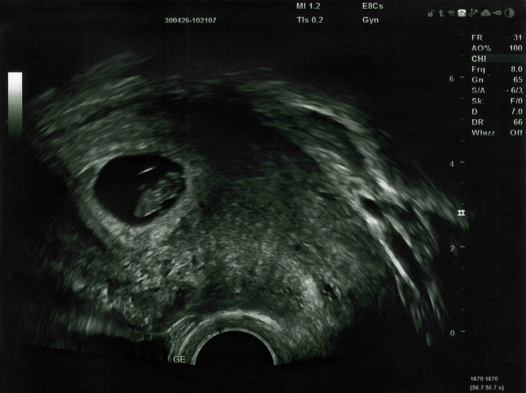 Ultraschallbild als persönliches Detail im Babybauchshooting